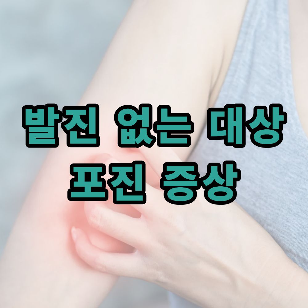 발진 없는 대상포진 증상