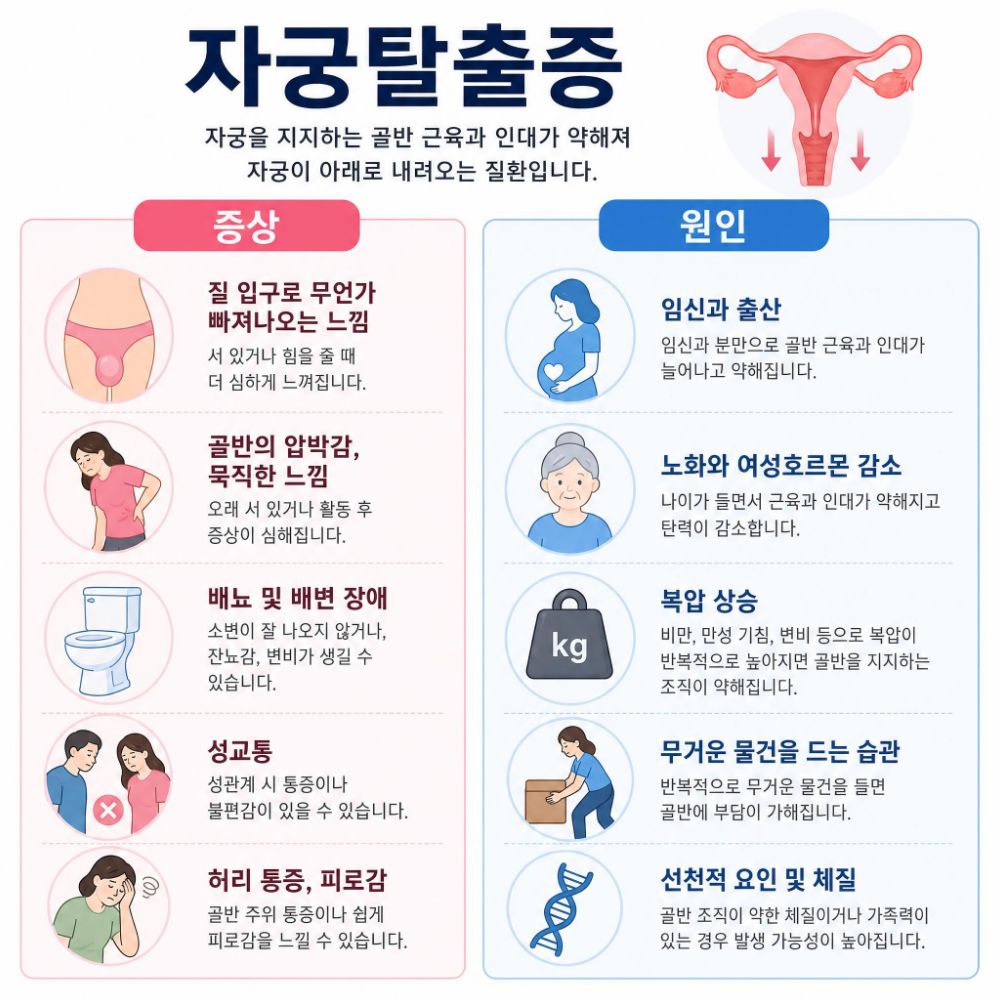자궁탈출증 증상과 원인